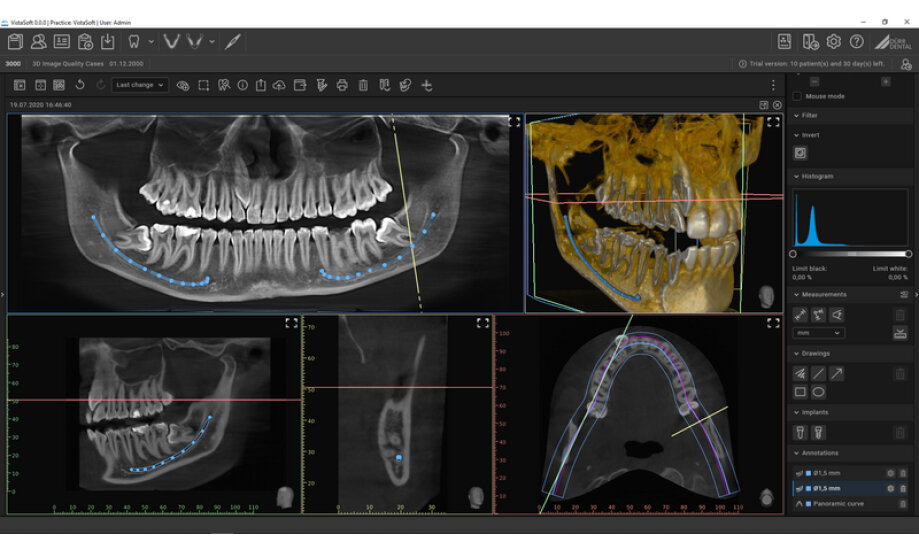 Stomatochirurgia v Bratislave: kedy je potrebné chirurgické riešenie v ústnej dutine?