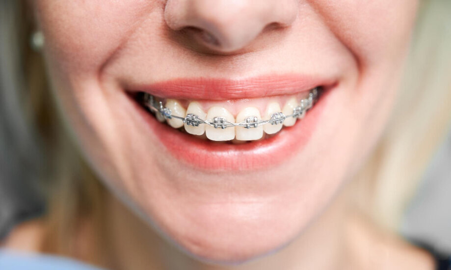 Klasický strojček a prečo zostáva jednou z najspoľahlivejších možností