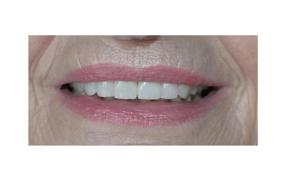 Stomatochirurgia v Bratislave: odborné riešenie zložitejších zubných problémov